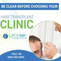 UK Hair Transplant Clinics image 5